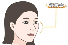 女人颧骨高面相全解析：苏民