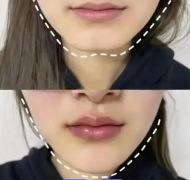 下巴凹陷是富貴還是窮？美人